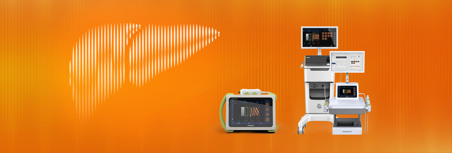 FibroScan®