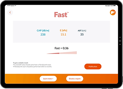 Fast™